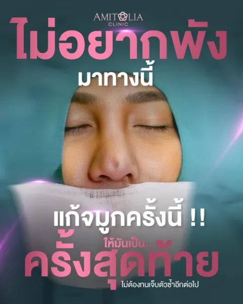 แก้จมูก