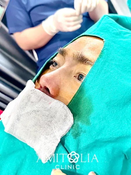 ทรงจมูกผู้ชาย