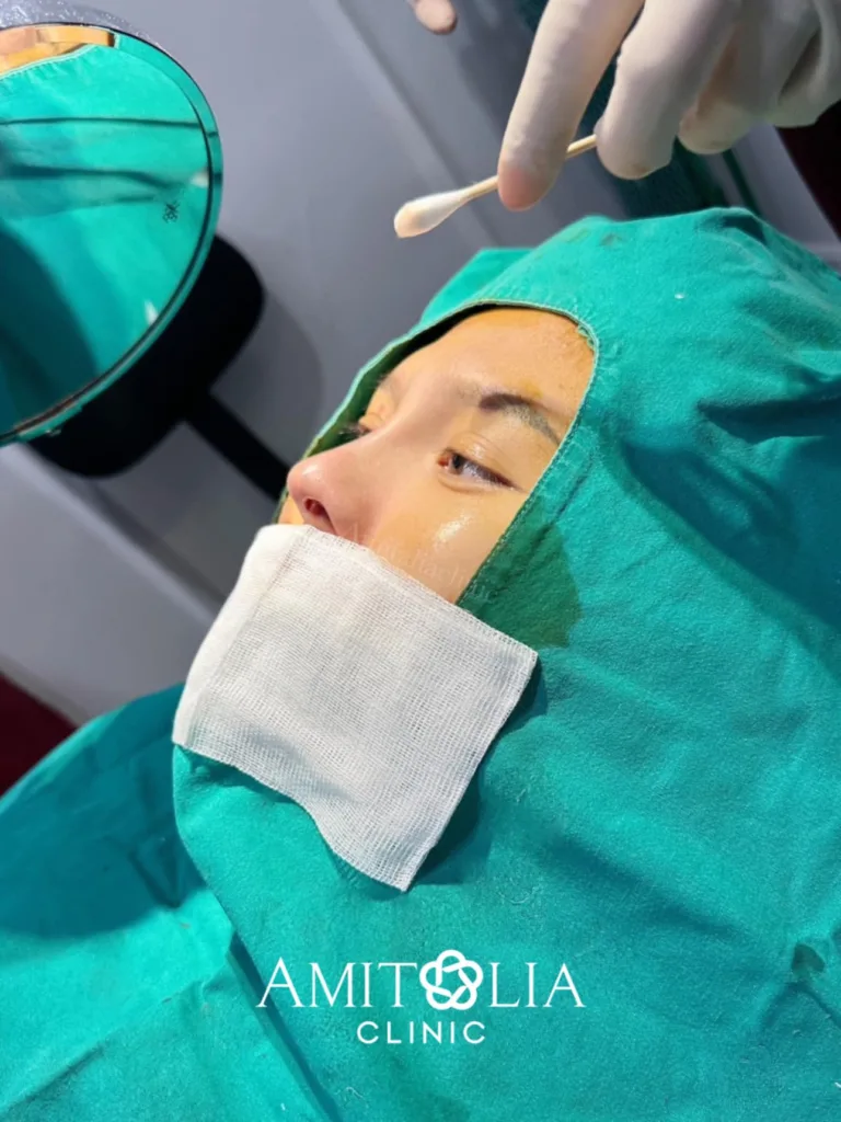 ทรงจมูก