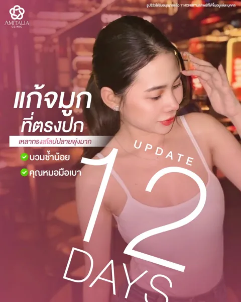 จมูกใหม่