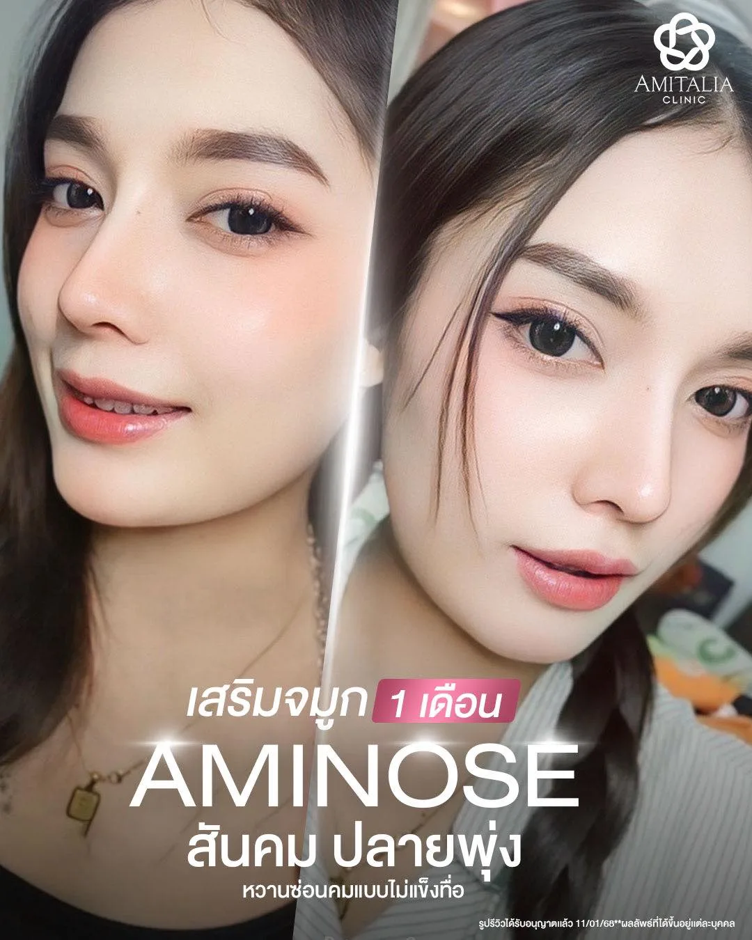ปลายจมูกพุ่งกำลังดี ไม่เป็นแท่ง