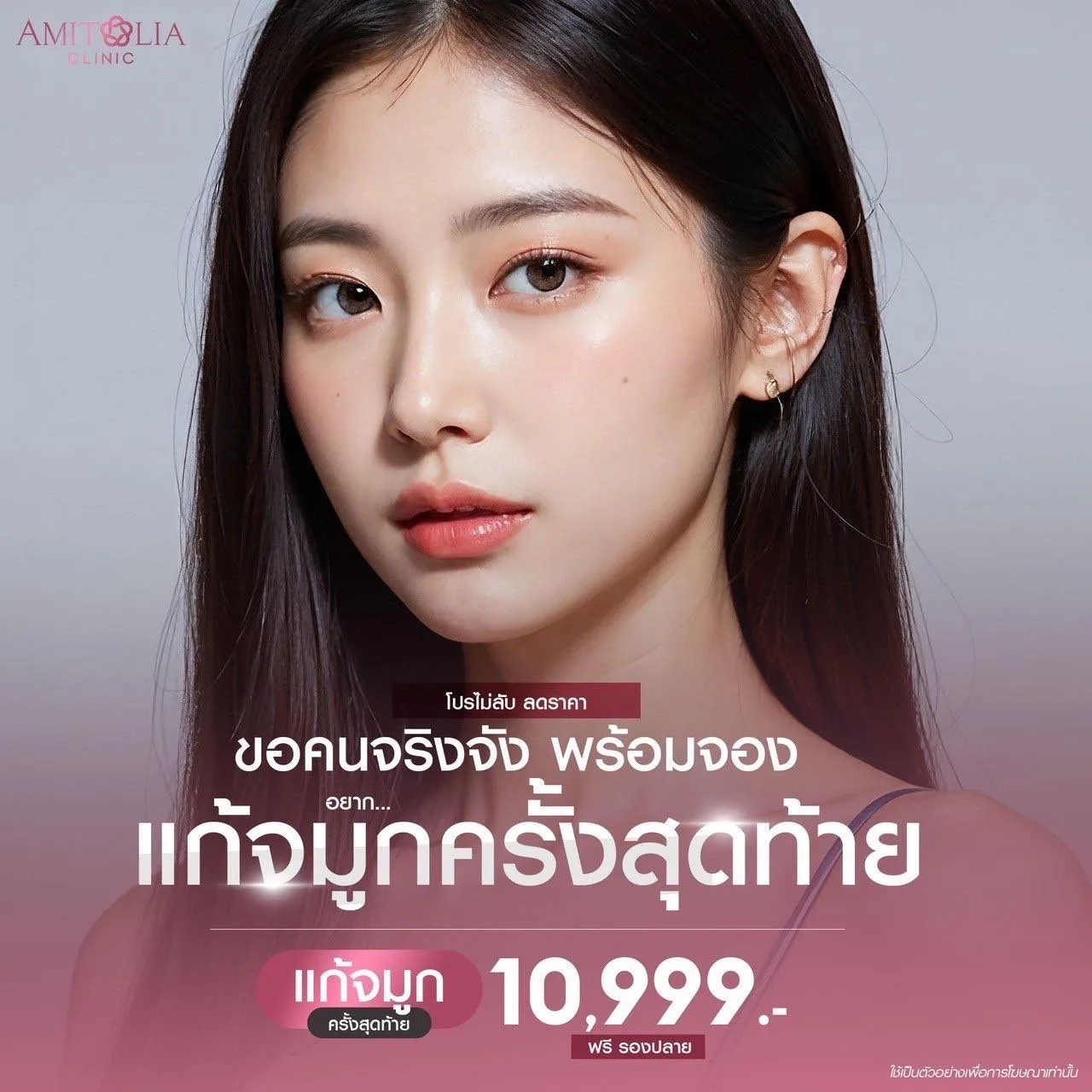 โปรโมชั่นสุดจึ้ง…แก้จมูกราคาดี ที่ทุกคนรอคอย