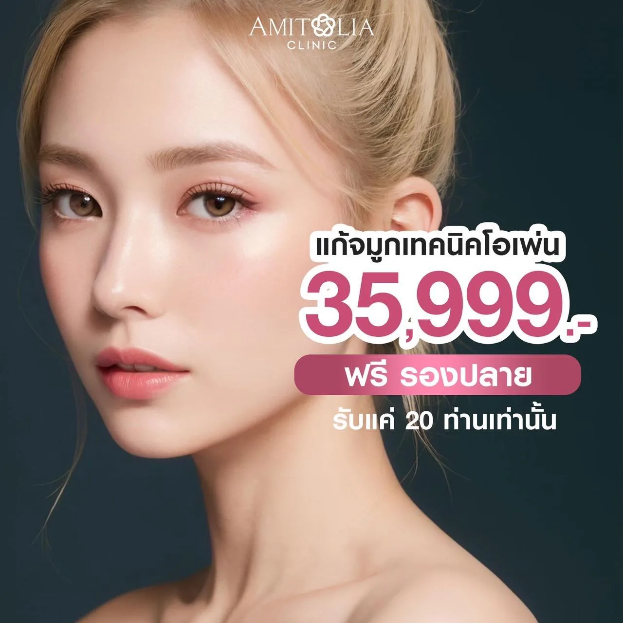 โค้งสุดท้ายราคานี้สำหรับคนที่อยากแก้จมูกเทคนิคโอเพ่น