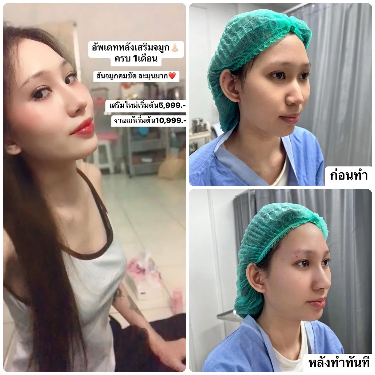 ขอบพระคุณคนไข้มากๆ ส่งรูปรีวิวอัพเดท
