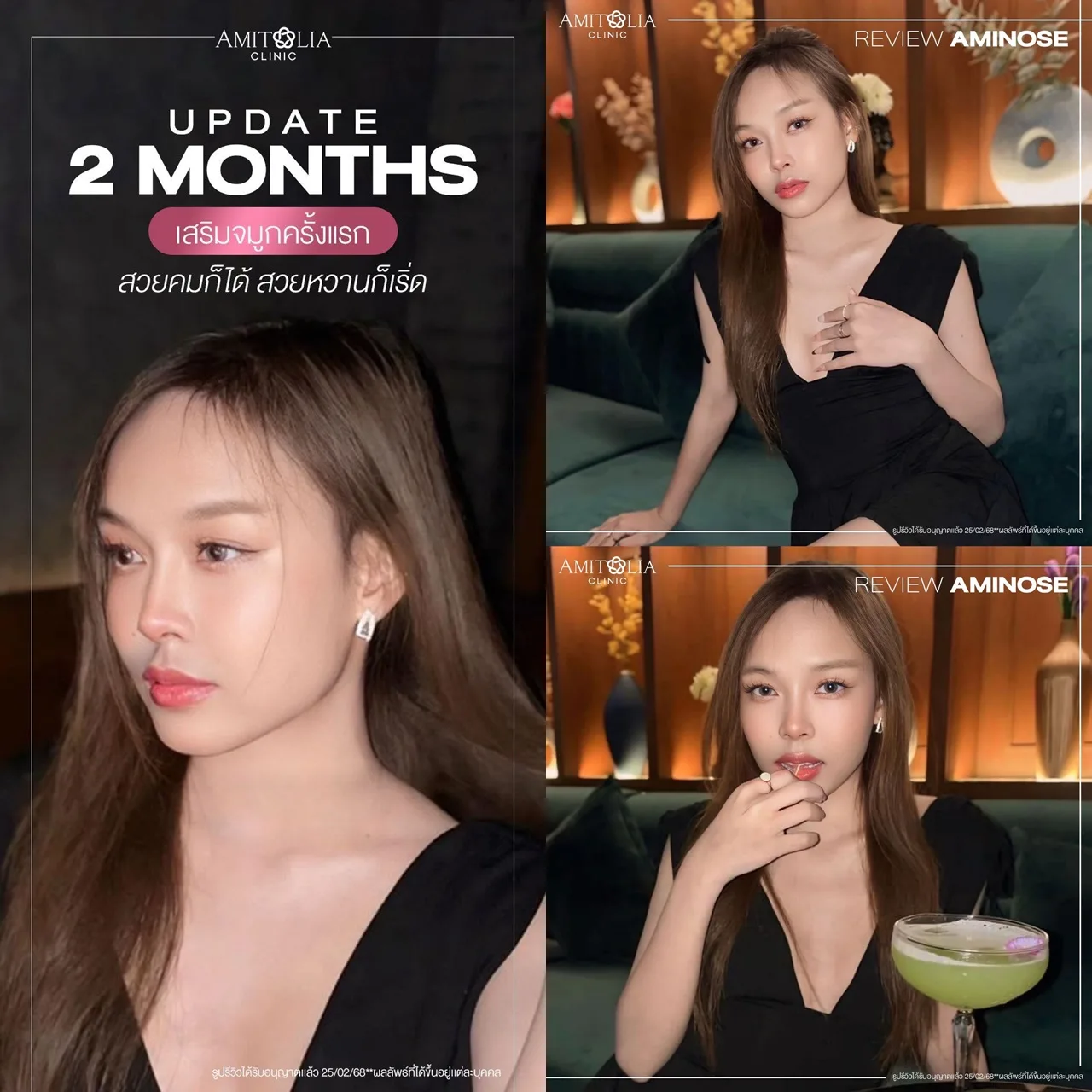 จมูกทรงนี้ละมุนเกินต้าน ไม่ต้องหามุมให้เหนื่อย