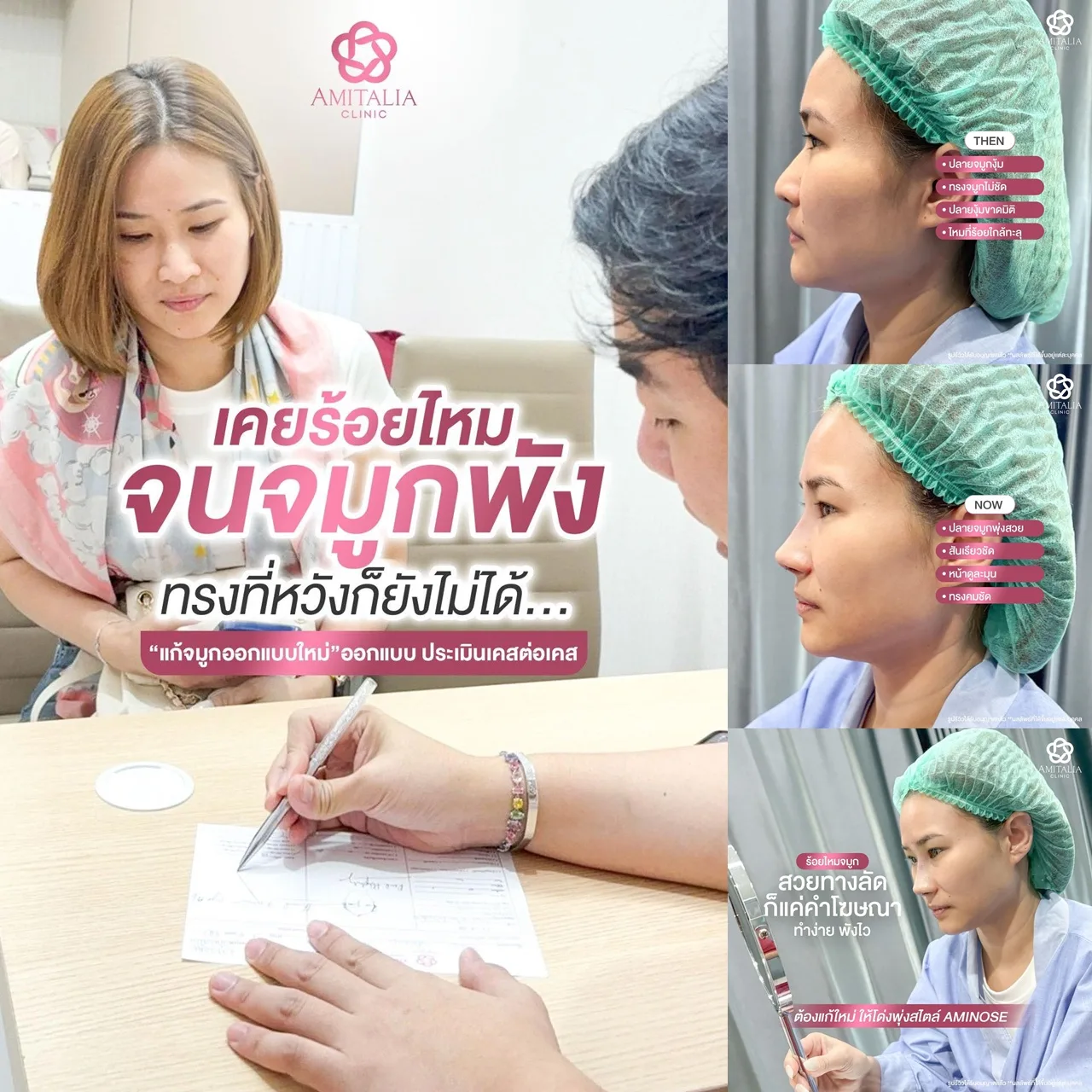 เคยร้อยไหม หวังให้จมูกพุ่งสวย