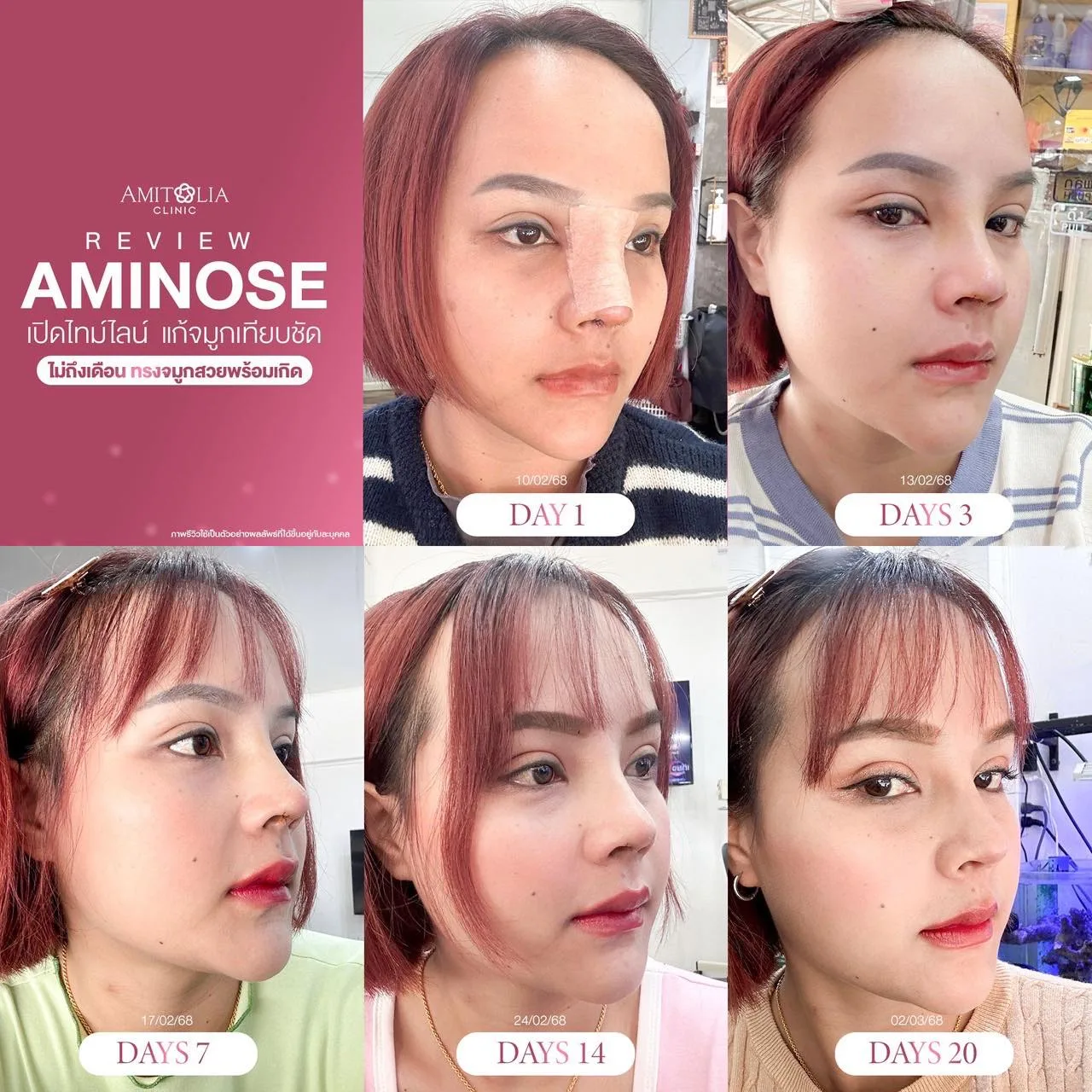 เปิดไทม์ไลน์จมูกใหม่ด้วยทรง AMINOSE