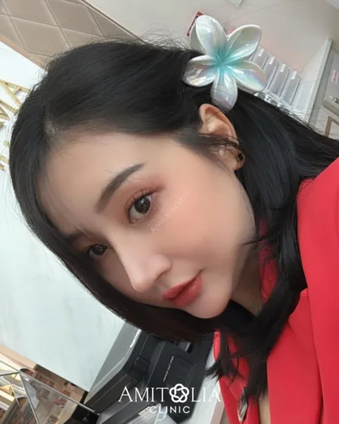 รีวิวแก้จมูก