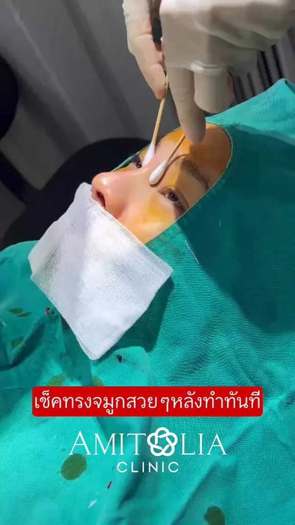 เช็คทรงจมูก