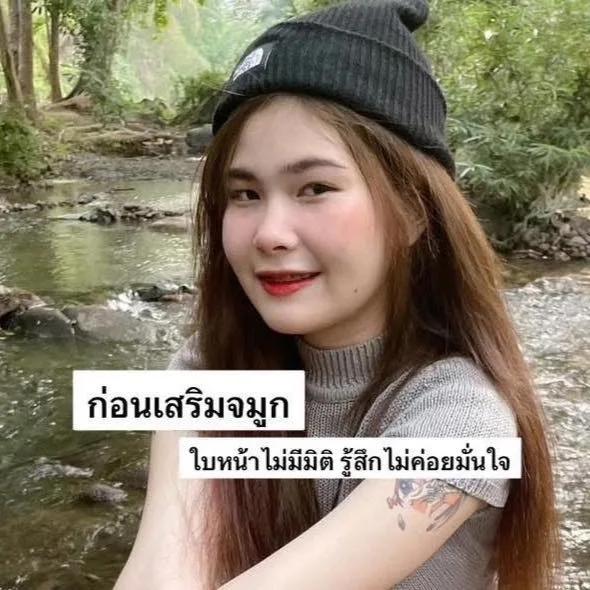 รีวิวเสริมจมูก 3 เดือน