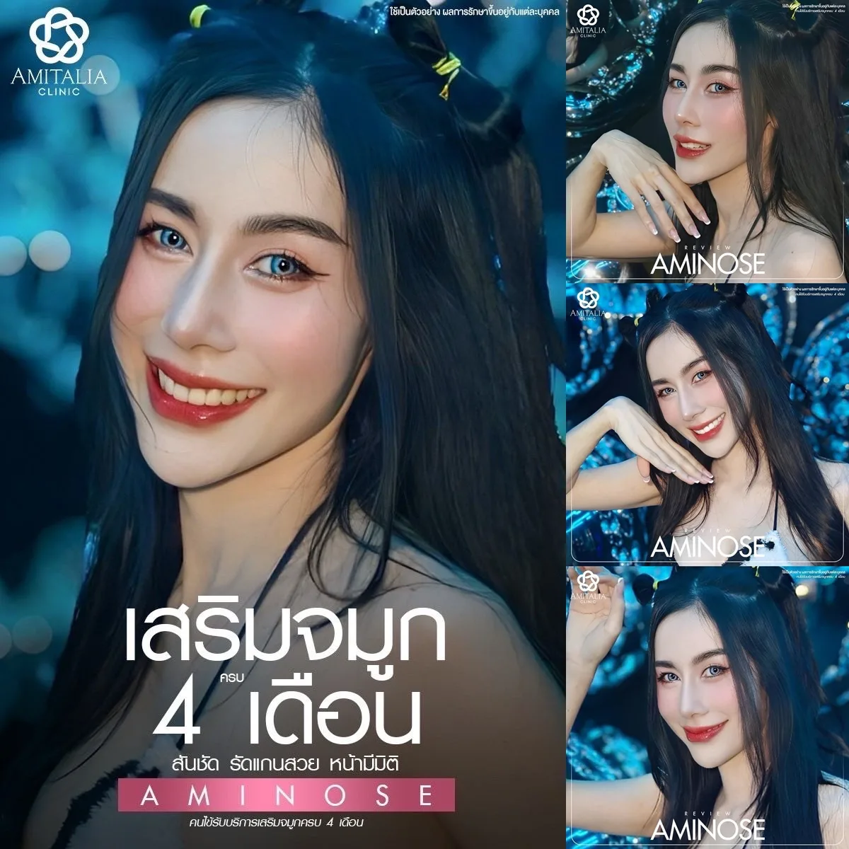 เสริมจมูก