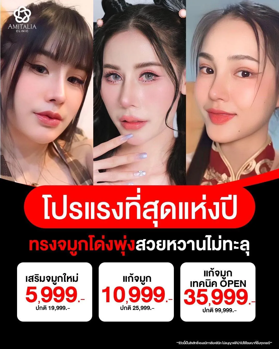 โปรทำจมูกเเรงๆ พร้อมเสิร์ฟเเล้วคร่าา