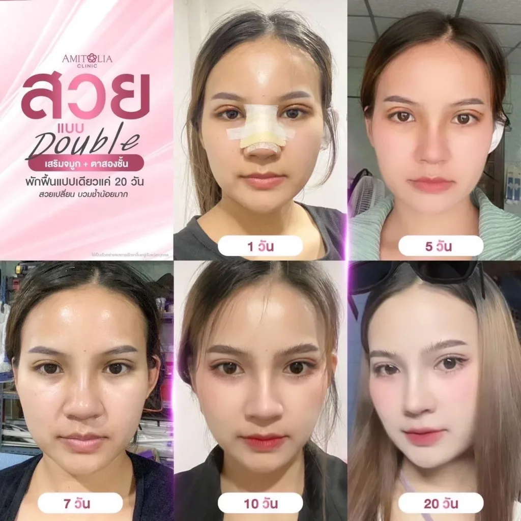 ศัลยกรรม