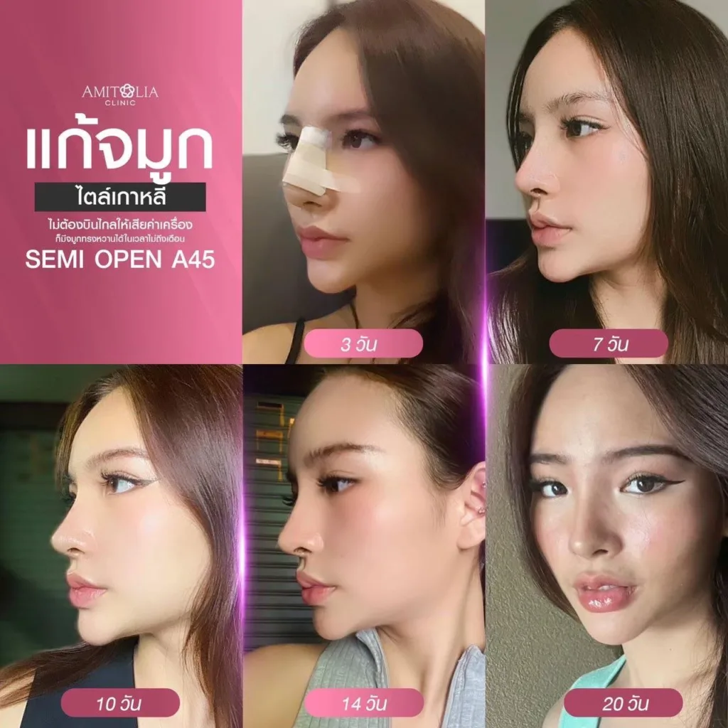 ศัลยกรรม