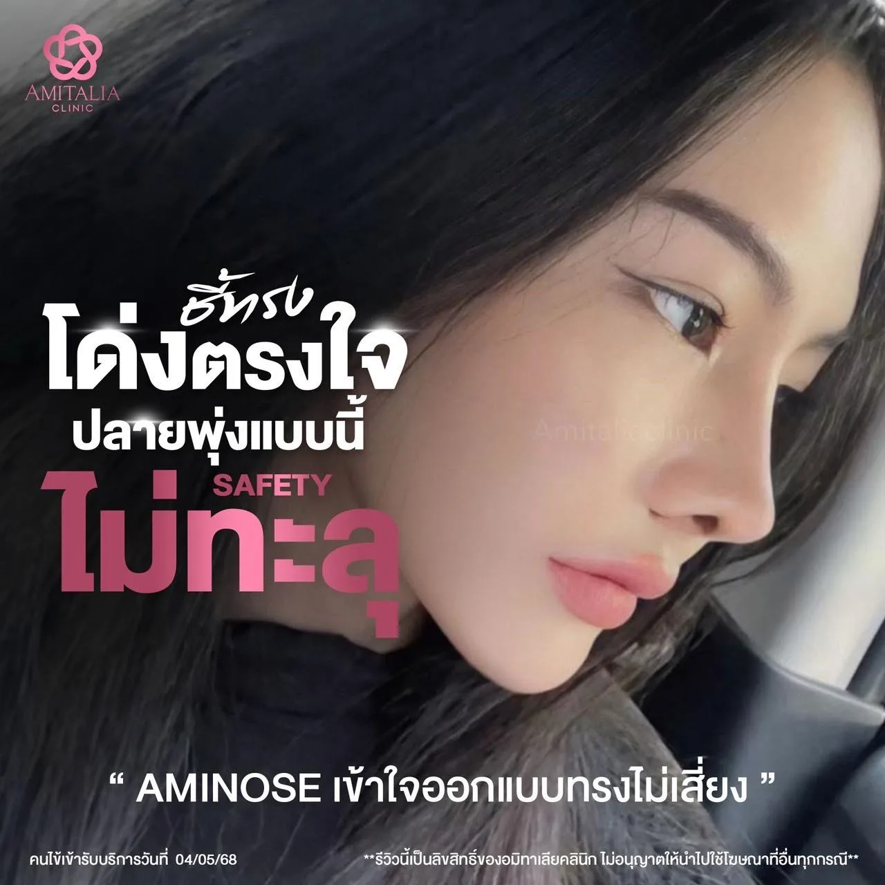 จมูกทรง