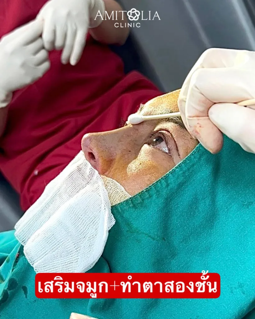 โปรศัลยกรรม