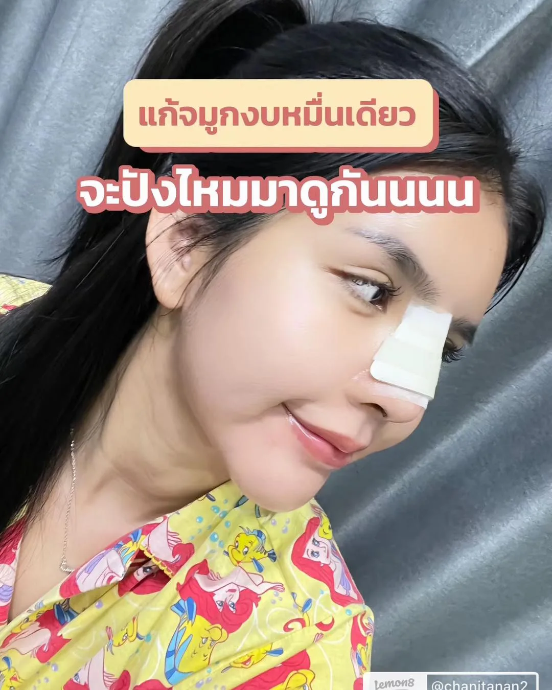 แก้จมูก