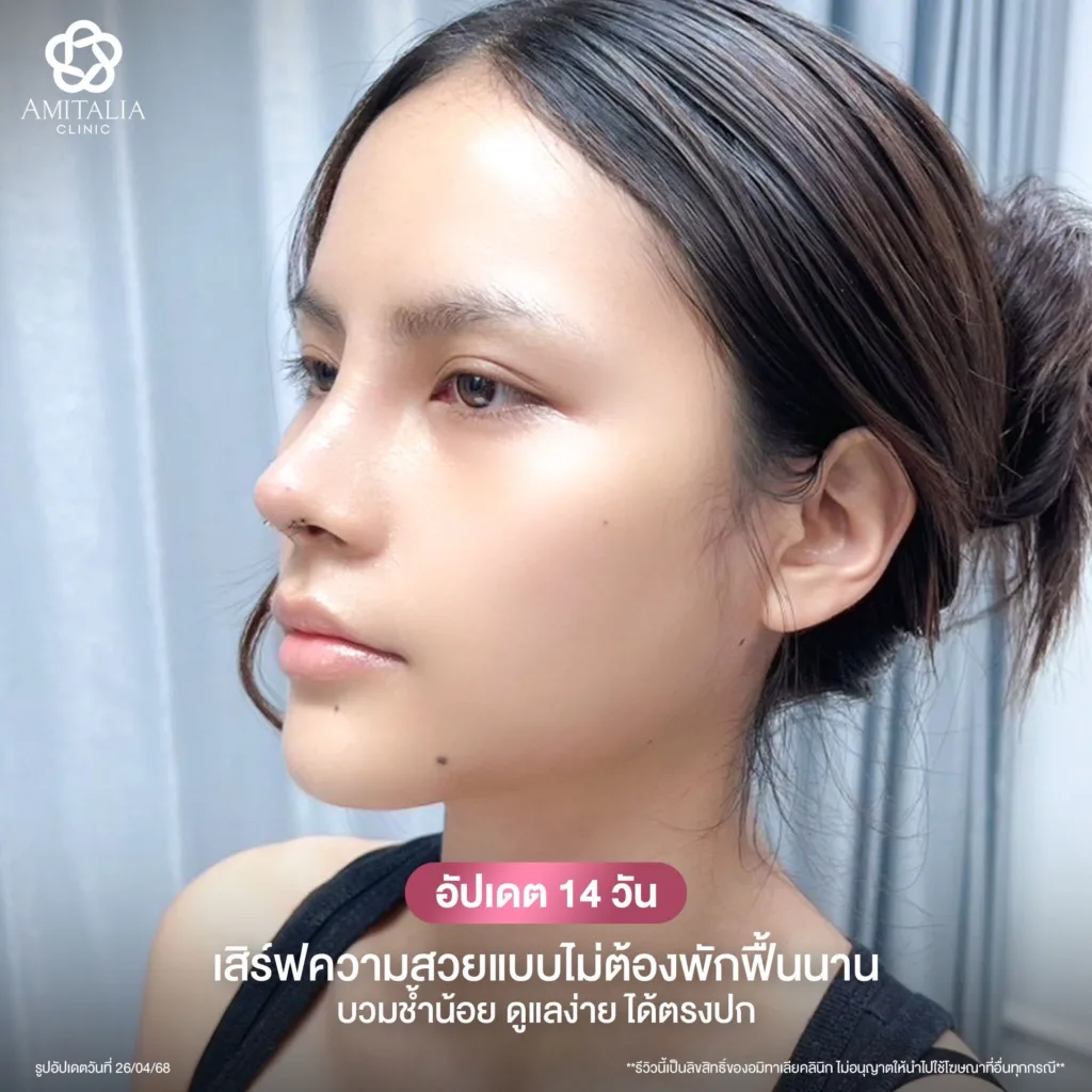 แก้จมูก