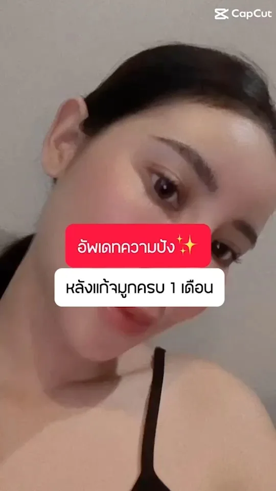 รีวิวแก้จมูก
