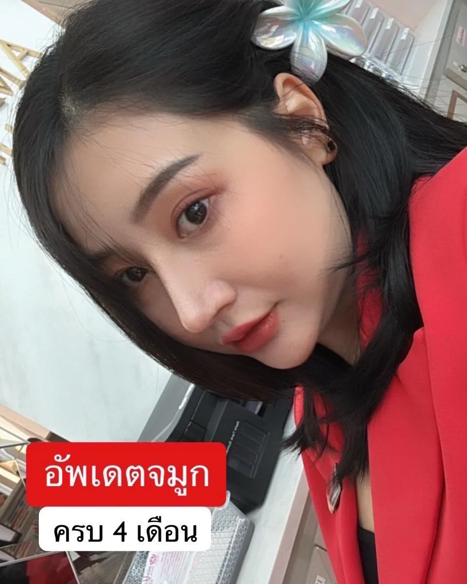 แก้จมูก