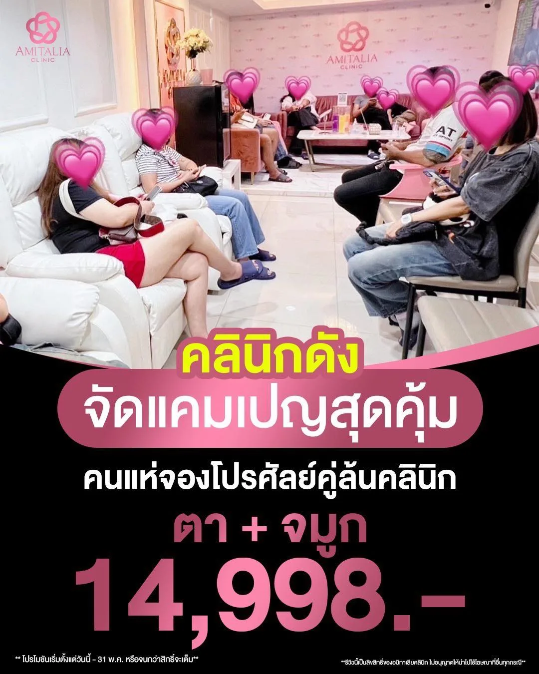 ทำตา + ทำจมูก ในงบแค่ 14,998.-