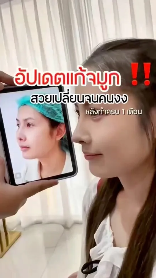 แก้จมูกครบ