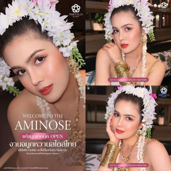 รีวิวแก้จมูก