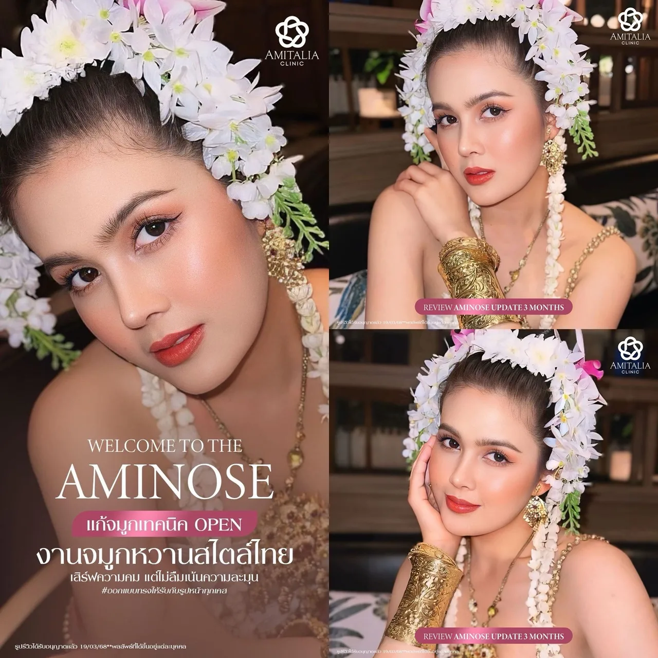 รีวิวแก้จมูก