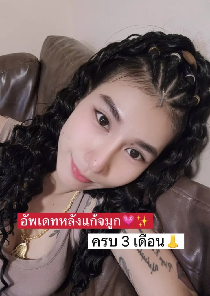 จมูกเอียง