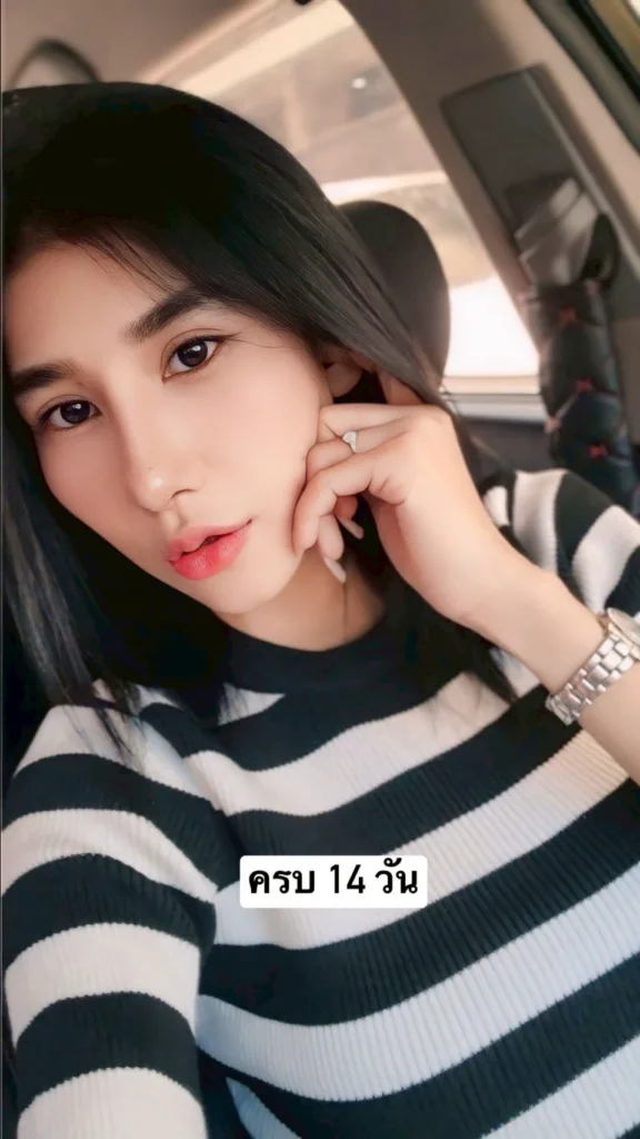จมูกเอียง