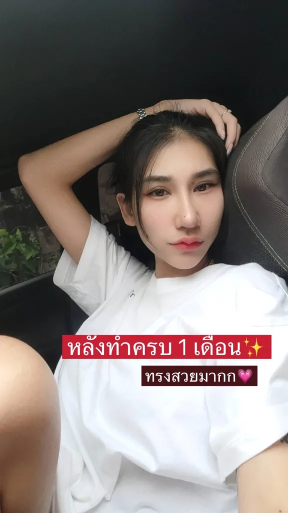 จมูกเอียง