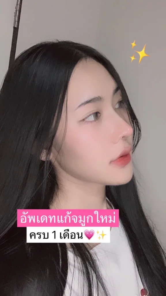 แก้จมูก