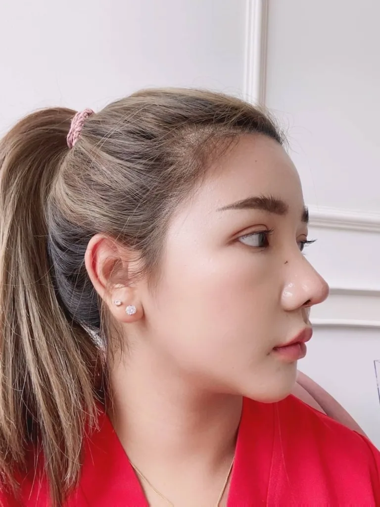 จมูกครั้งแรก