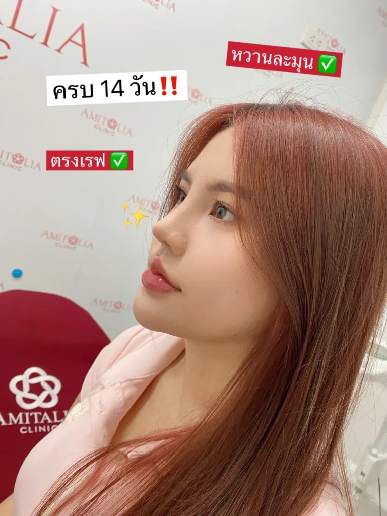 อัพเดทแก้จมูก