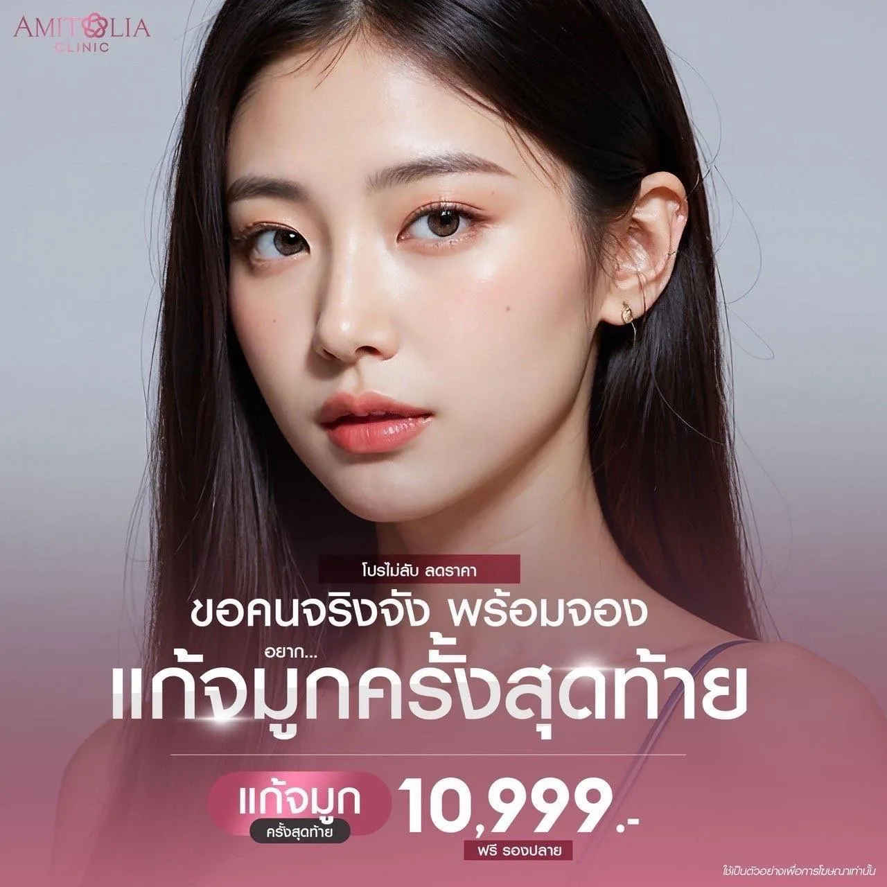 แก้จมูกราคา 10,999 บาท ของแถมอีก9รายการ