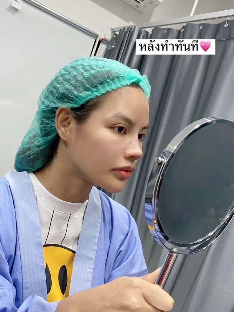 จมูกบาน