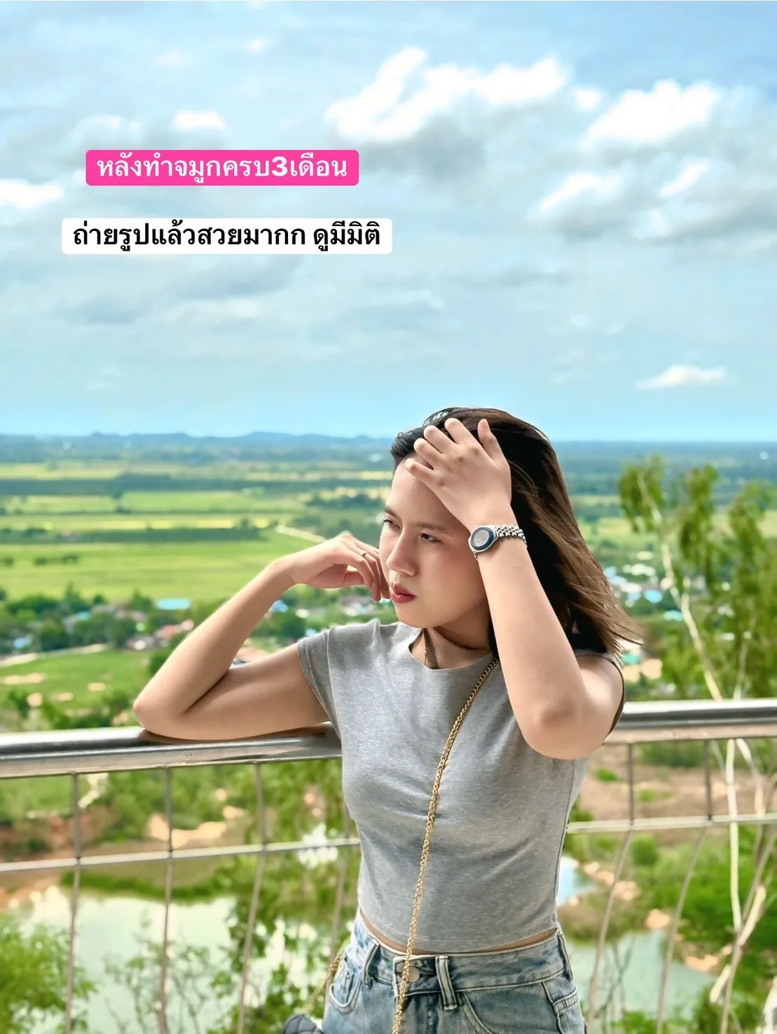 เสริมจมูก