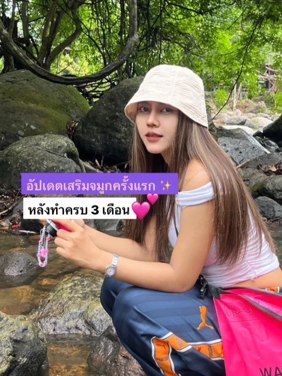 ศัลยกรรมครั้งแรก