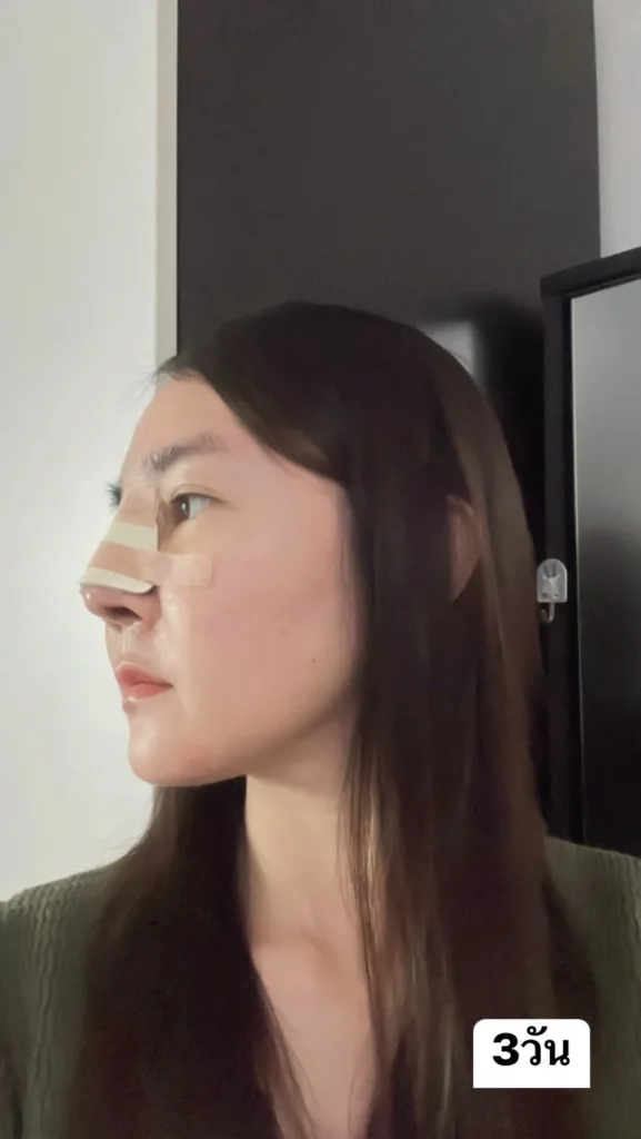 จมูกแท่งใหม่