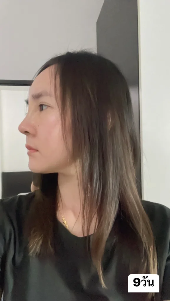 จมูกแท่งใหม่