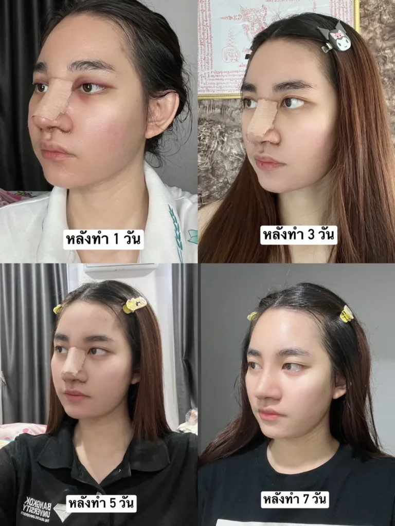 ศัลยกรรม