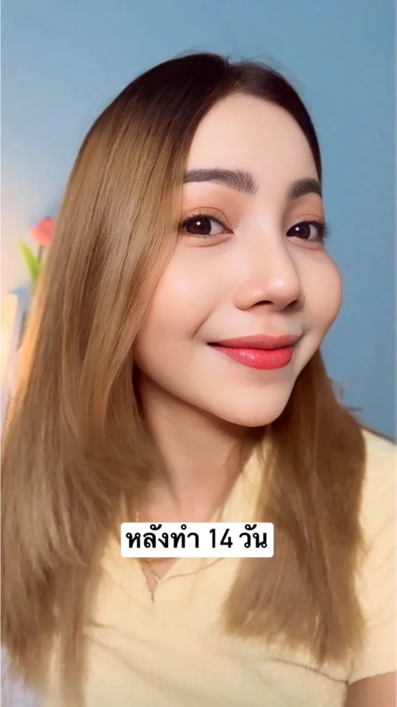 แก้จมูก