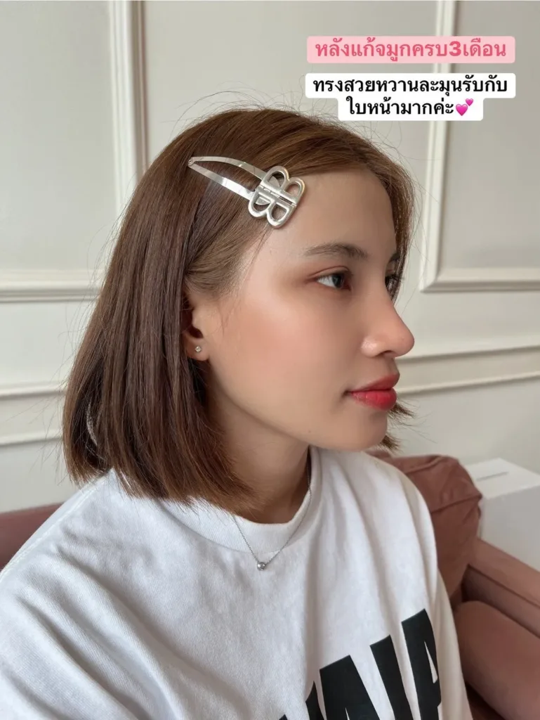 แก้จมูก