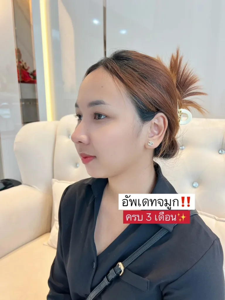 จมูกแท่งแรก