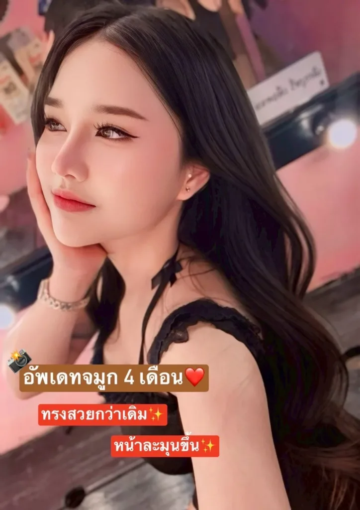 แก้จมูก