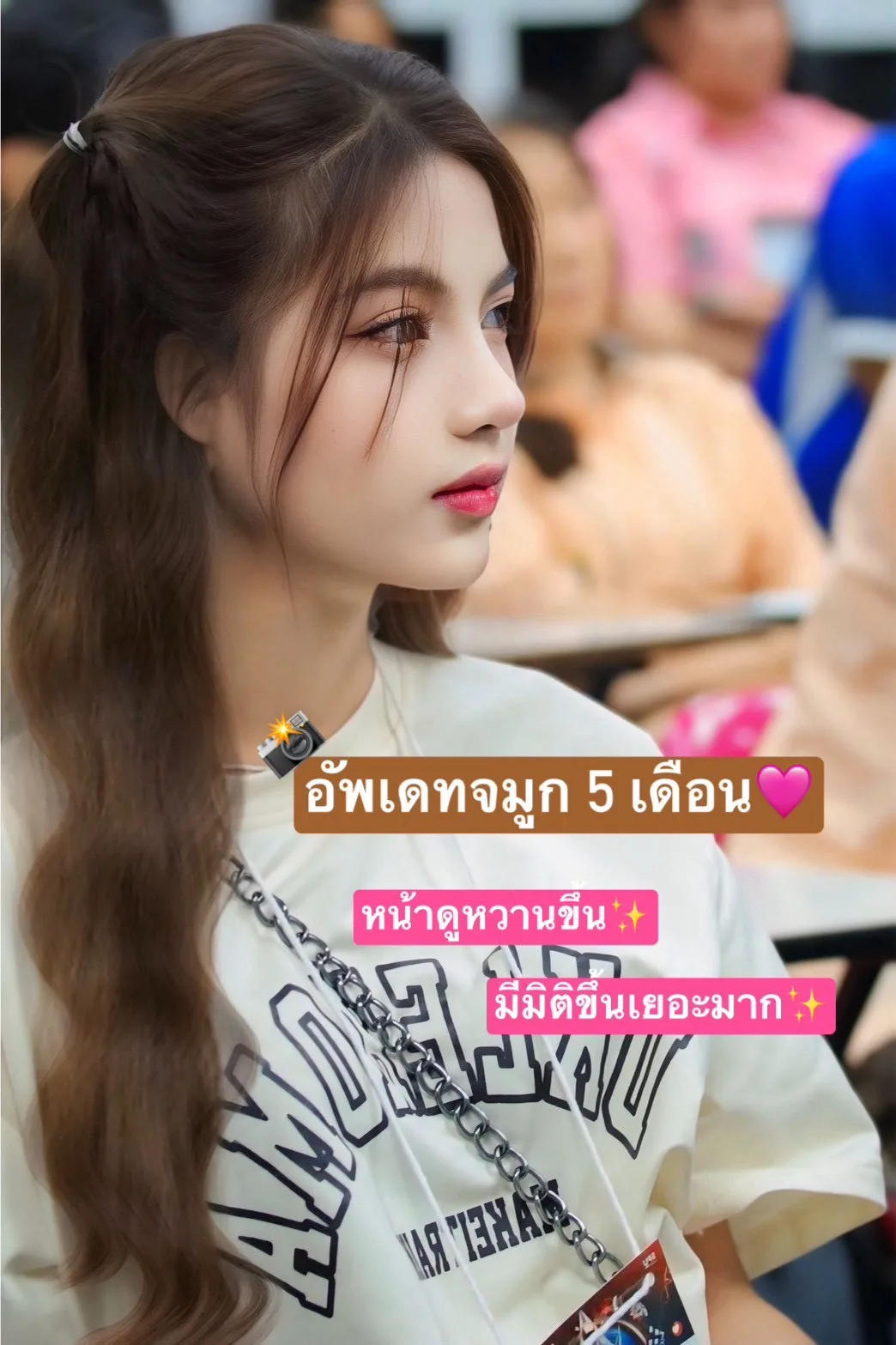 เสริมจมูก