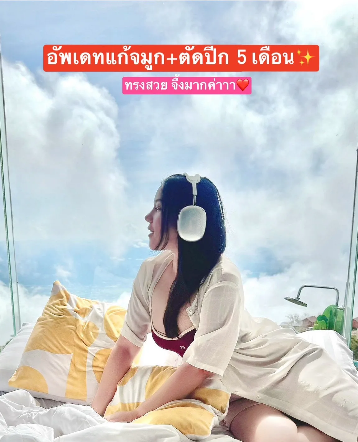 แก้จมูก+ตัดปีก ทำออกมาแล้วไม่คิดว่าจะปังขนาดนี้