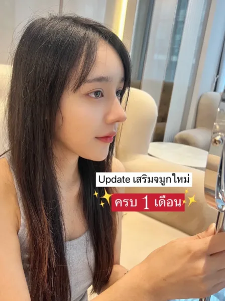 เสริมจมูกใหม่