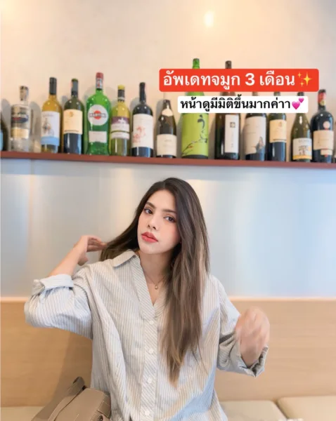 เสริมจมูก