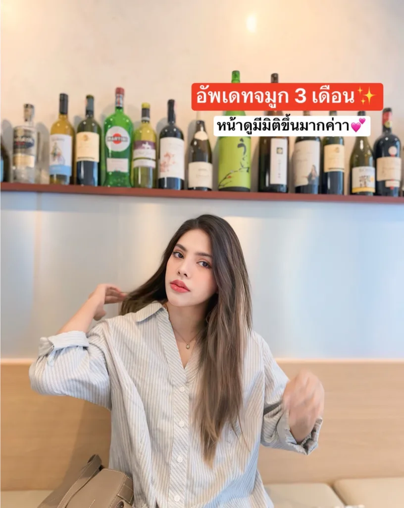 เสริมจมูก